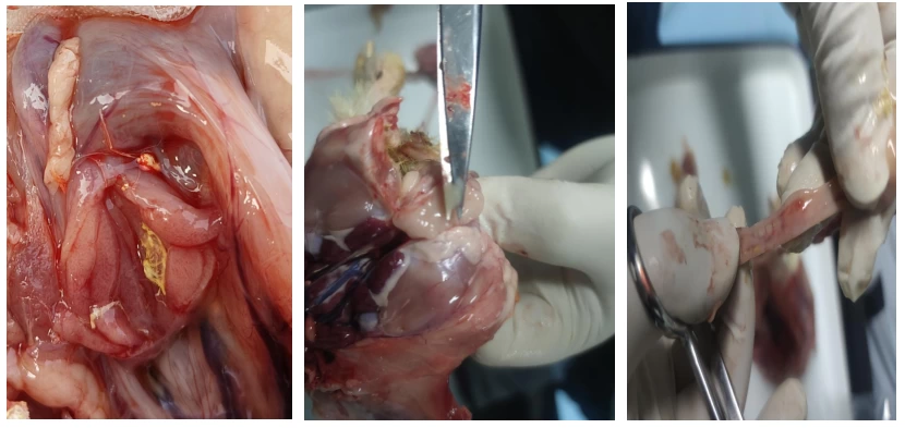 复抗粉加腺胃康成功案例