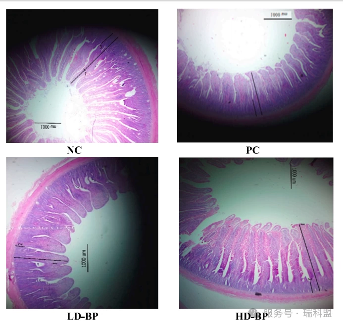 【文献快览】破局&ldquo;无抗&rdquo;时代！研究揭示：噬菌体联手益生菌，如何打赢肉鸡肠道健康保卫战